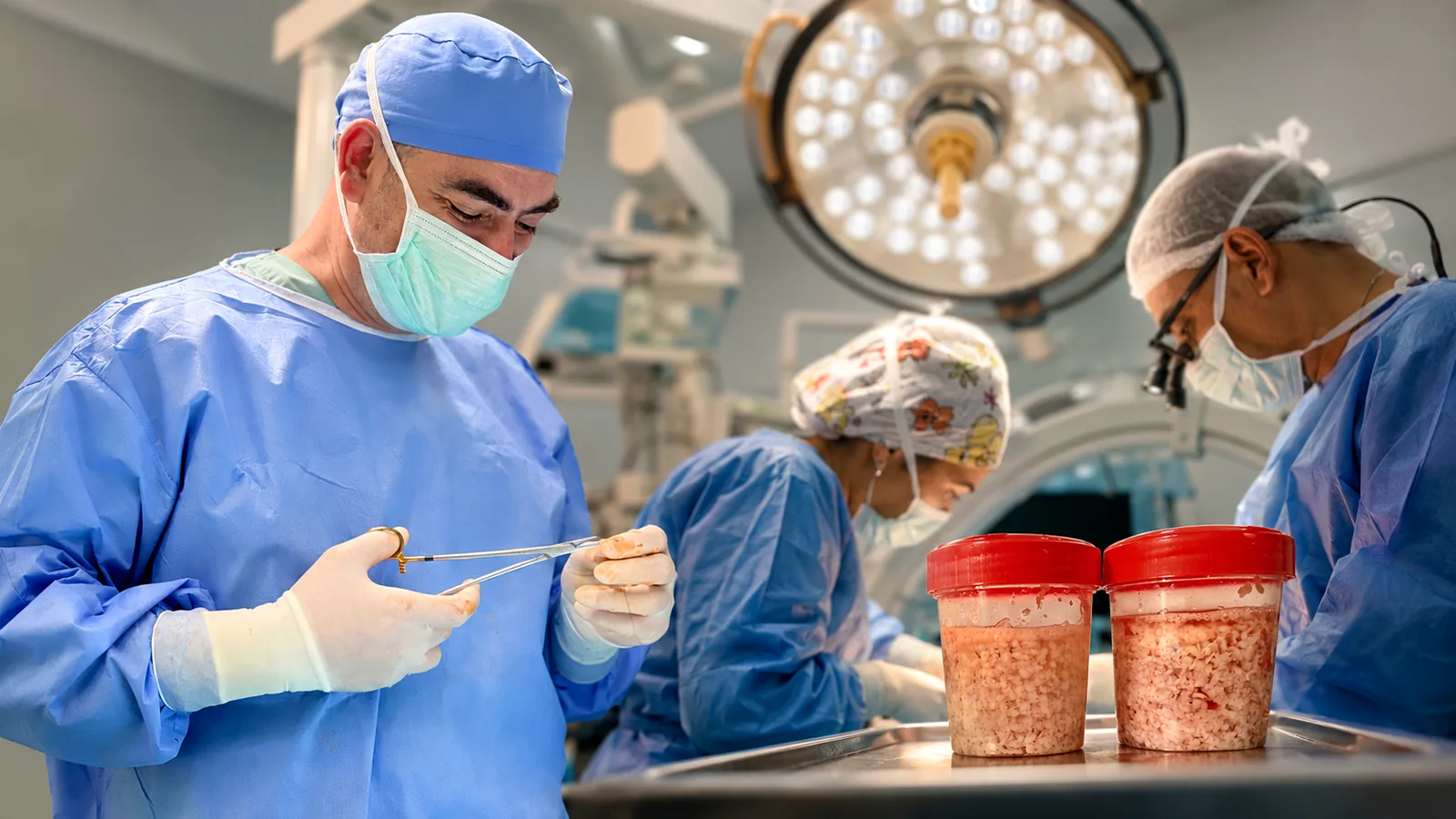 HoLEP ameliyatı ve prostat dokusu klinik görseli