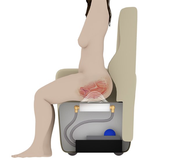 Magnetic Chair and Pelvic Floor Exercise